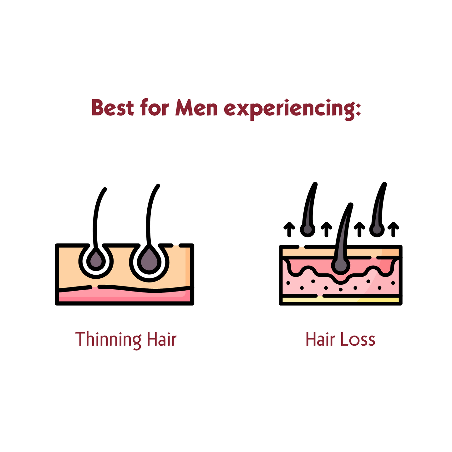 FOLTENE Strengthening Shampoo for MEN with Thinning Hair & Hair Loss