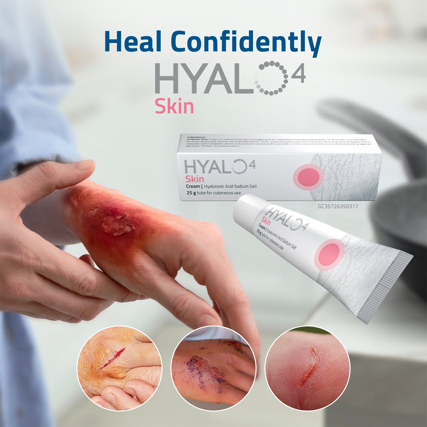 HYALO4 Skin Cream 25 g | Wound Healing Cream