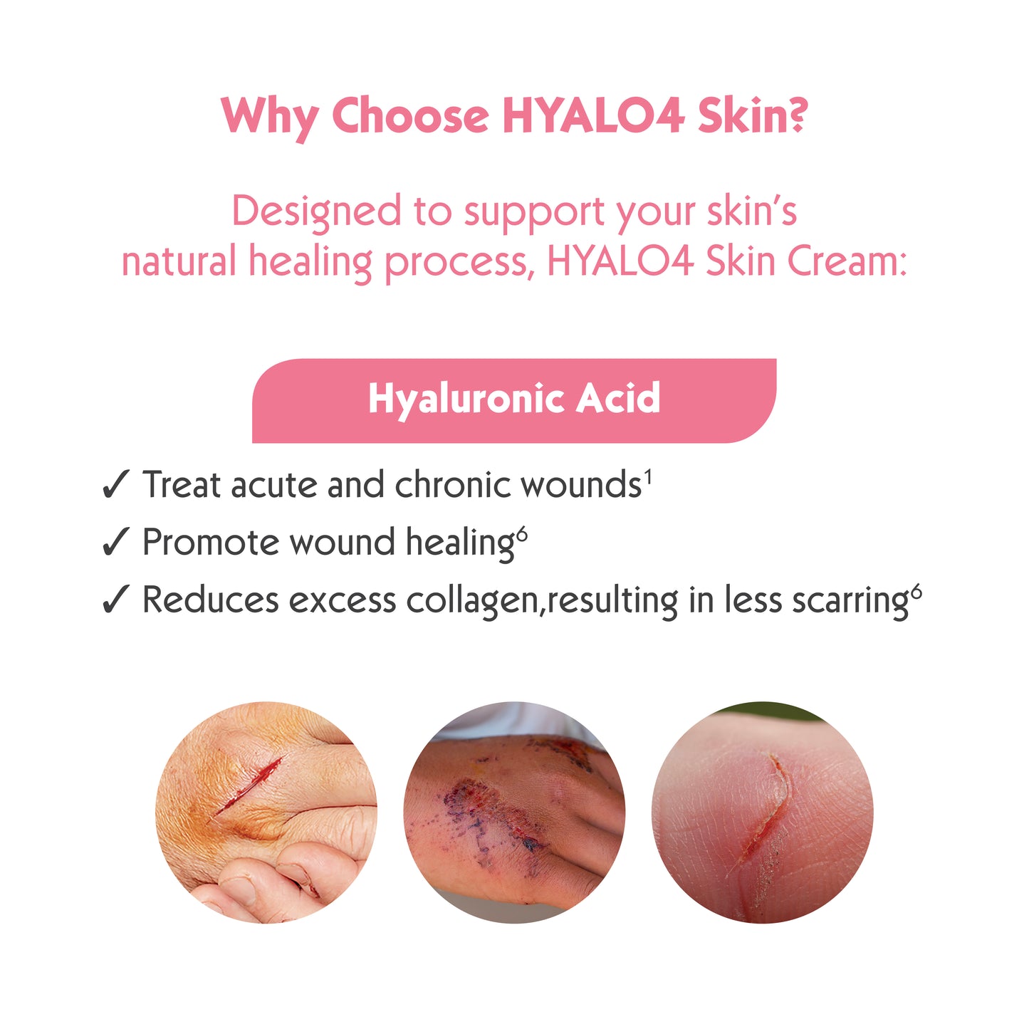 HYALO4 Skin Cream 25 g | Wound Healing Cream